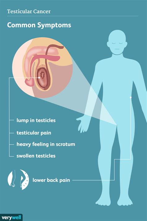 Testicular Cancer: Signs, Symptoms, and Complications