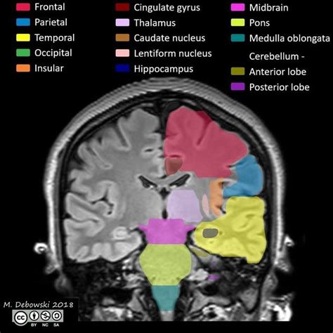 Radiology Quiz 61691 | Radiopaedia.org | Radiology, Radiology student, Radiology imaging