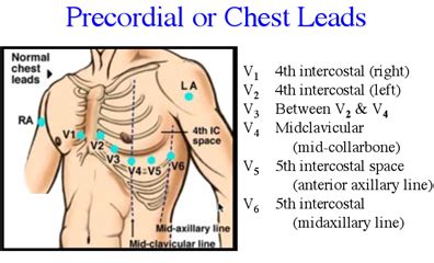 Precordial or chest leads