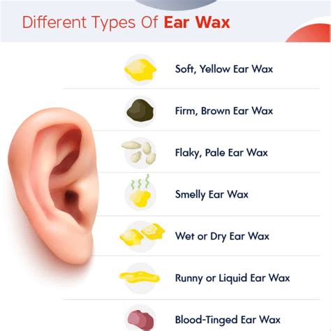 Earwax Types | Different Kinds of Ear Wax