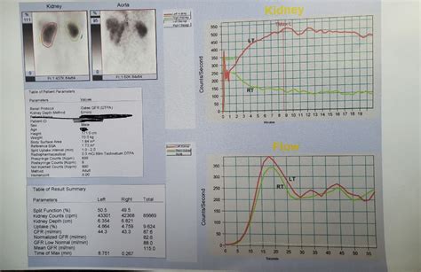 DTPA Renal Scan: Introduction Archives - Medical Notes