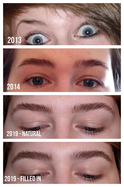 Rogaine For Eyebrow Growth Before And After - EyebrowShaper