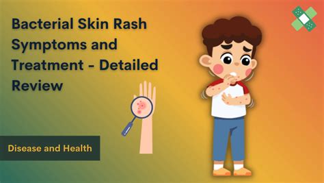 Bacterial Skin Rash Symptoms And Treatment Detailed Review – NBKomputer