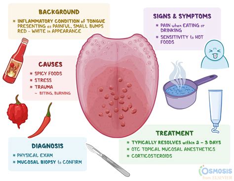 Transient Lingual Papillitis: What Is It, Causes, Symptoms, and More | Osmosis