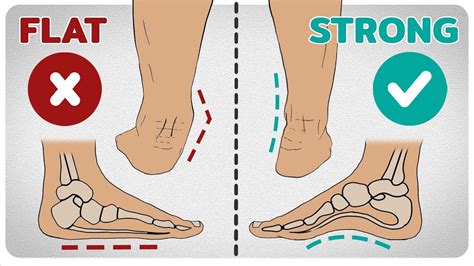 The Arches Of The Foot Longitudinal Transverse TeachMeAnatomy | 6b.u5ch.com