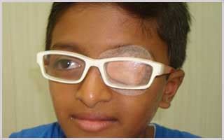 Treatment of Lazy Eyes in Navi Mumbai | Amblyopia | Kharghar - Utsav Eye Clinic