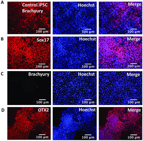 Expression of endoderm, mesoderm and ectoderm markers in immunoassayed ...