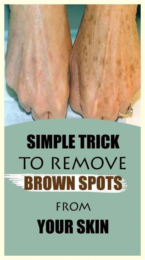 12 awesome ways to get rid of brown spots – Artofit