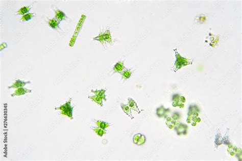 Freshwater aquatic plankton under microscope view. Stock Photo | Adobe ...