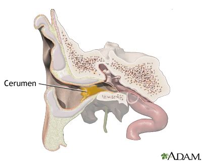 The Anatomy Of Ear Wax