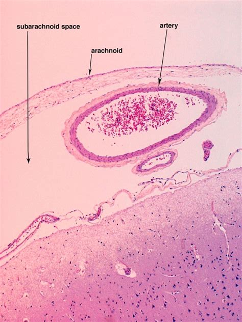 Arachnoid Mater Histology