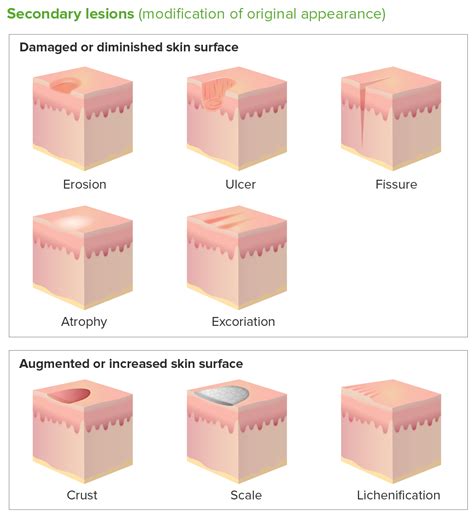 Skin Lesions Types