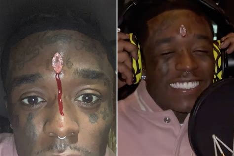 Lil Uzi Vert fears he could DIE after getting $24million pink diamond implanted in his forehead ...