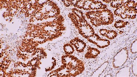 Immunohistochemistry Techniques, Strengths, Limitations and Applications | Technology Networks