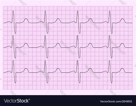 Heart analysis electrocardiogram graph ecg Vector Image