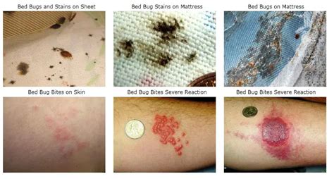 Bed Bug Symptoms: Pictures, When They Appear and Treatment