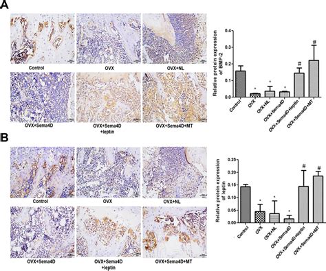 A Immunohistochemical detection and quantitative analysis of BMP-2... | Download Scientific Diagram