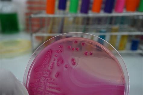 Identification of Aerobic Bacteria by Conventional Technique ...