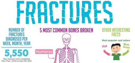 5 Most Common Bone Fractures for Kids | Sports and Spine Orthopaedics