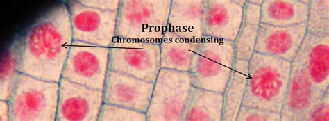 Interphase vs prophase - bingerscape