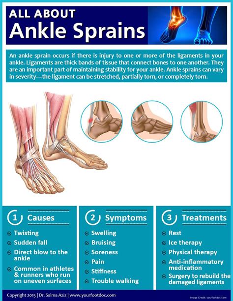 Chronic Ankle Joint Pain: What Causes Chronic Ankle Instability?