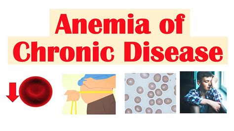 Anemia Of Chronic Disease