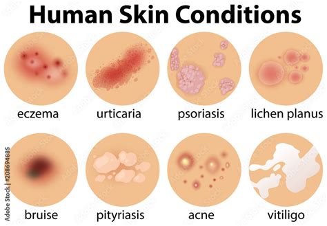 A Set of Human Skin Conditions Stock Vector | Adobe Stock