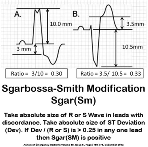 STEMI and STEMI Equivalents, i.e. Who Needs the Cath Lab Now! — Taming the SRU