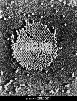 Transmission electron micrograph (TEM) of rhinoviruses, which cause the common cold ...