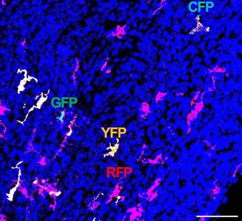 Role of Phagocyte Types in Kidney Inflammation revisited