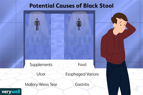 What Causes Black or Tarry Stool?