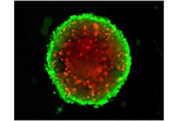 3D Spheroid Assays For Cancer Drug Screening