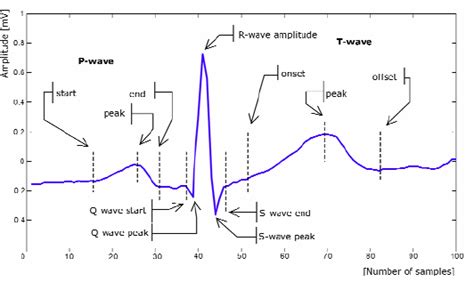 An example ECG beat | Download Scientific Diagram