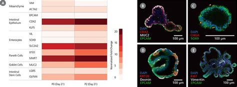 STEMdiff™ Intestinal Organoid Culture Kit | STEMCELL Technologies