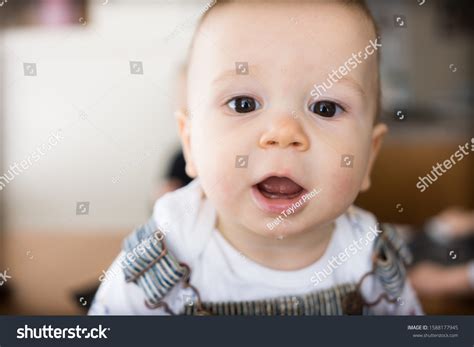 Young Caucasian Boy Buck Teeth Smiles Stock Photo 1588177945 | Shutterstock