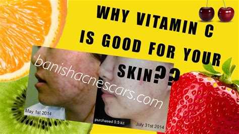 How Is Vitamin C Good For Your Skin