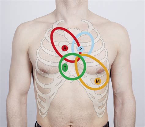 [Solved] NU 535: Cardiac Assignment: Where would you auscultate the ...