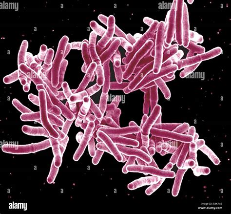 Mycobacterium Tuberculosis Microscope