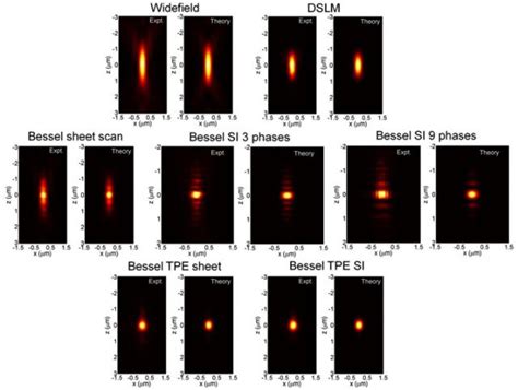 Bessel beam plane illumination microscopy: another smart solution for an old challenge ...