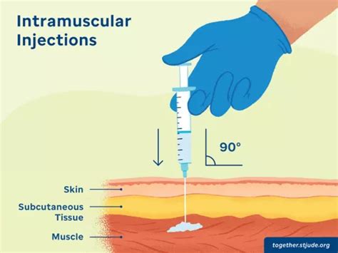 Intramuscular Injection