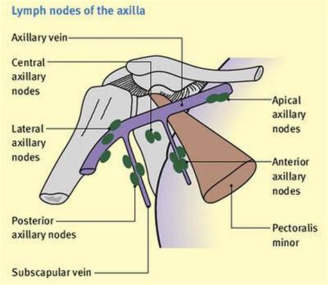 Pictures Of Axillary Lymph Nodes