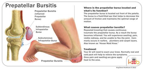 Carpet Layers Knee / Prepatellar Bursitis Wikipedia - Google has many special features to help ...