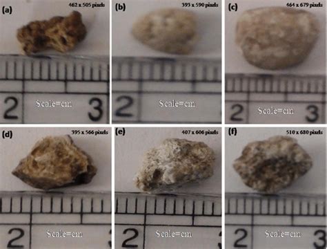 Types of Kidney stones from human samples (a) Pure calcium oxalate ...