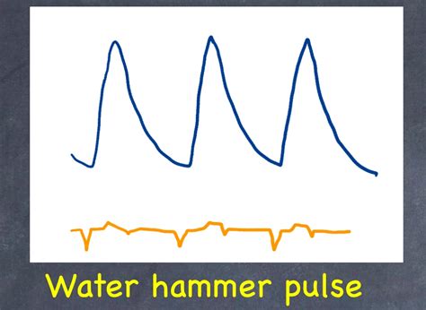 How to check Paediatrics cardiac pulse – MediGac