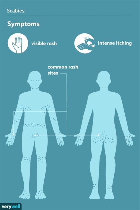 Scabies: Signs, Symptoms, and Complications