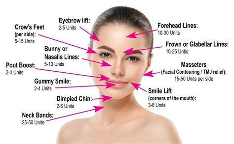 Printable Botox Injection Face Map - Printable Templates