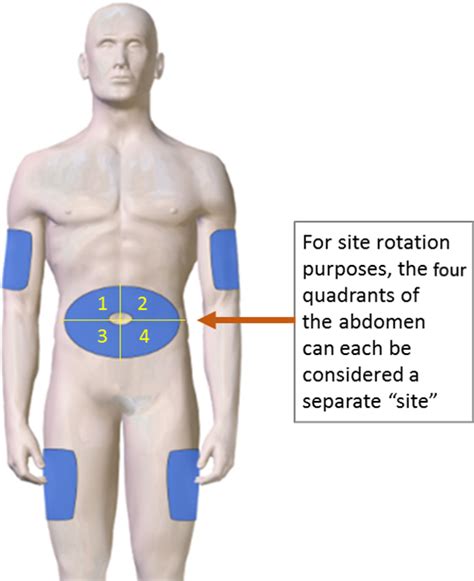 Common subcutaneous injection sites | Download Scientific Diagram