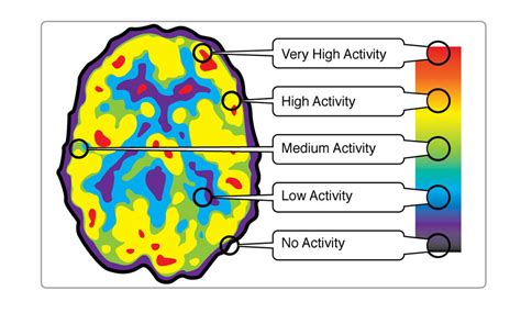 Brain Imaging Technologies