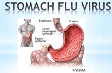 Viral Gastroenteritis (Stomach Flu)