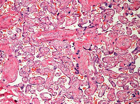 File:Placenta histology 004.jpg - Embryology